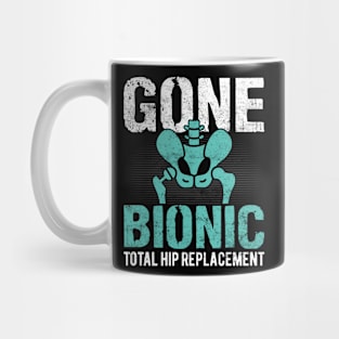 Total Hip Replacement Funny Joint Hip Surgery Recovery Mug